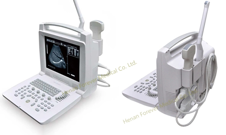 Ce Approved Hospital Equipment Sonar Baby Monitor Portable Ultrasound (YJ-U318)